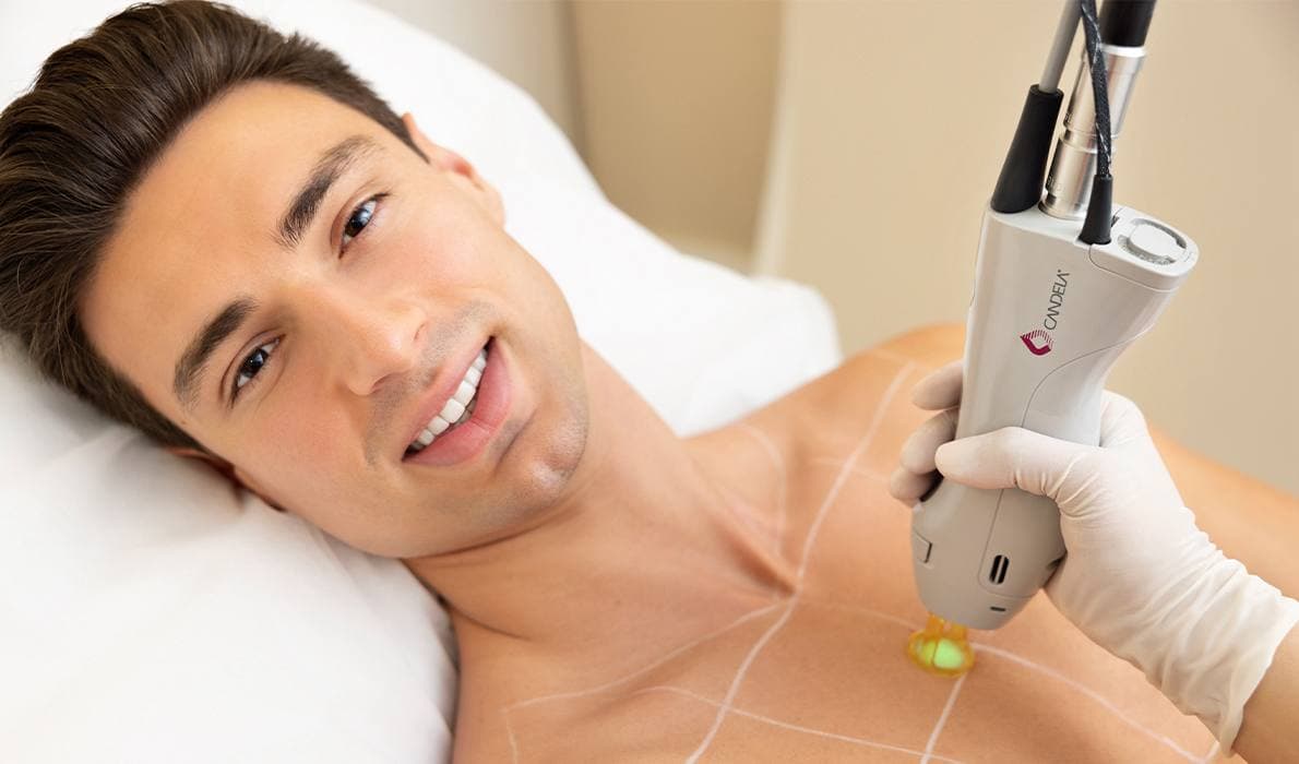 Laser Hair Removal for Men
